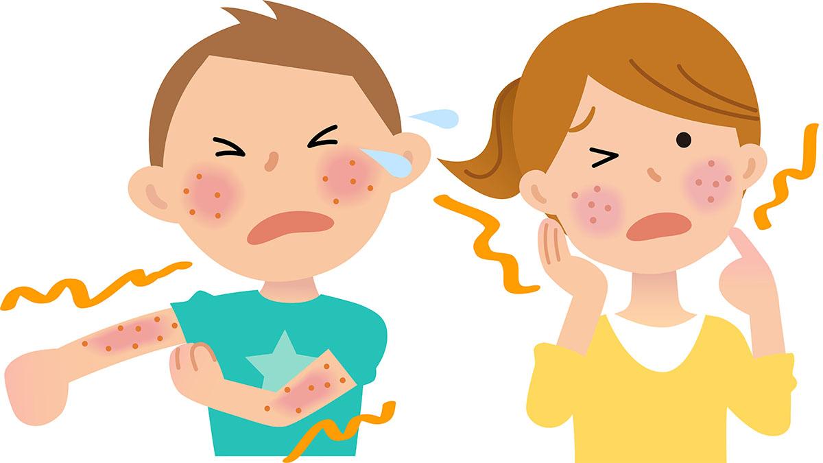 simptomi allergii
